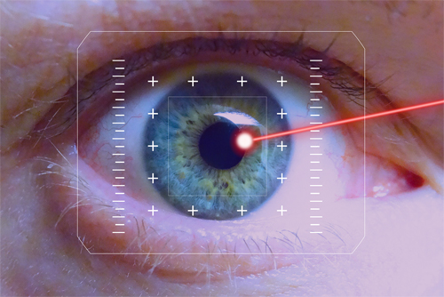 YAG-Laser bei Nachstar | Netzhaut-ARGON-Laser bei Diabetes, bei Gefäßverschlüssen, bei ausgeprägter Netzhautdegeneration | Laser bei Glaukom
